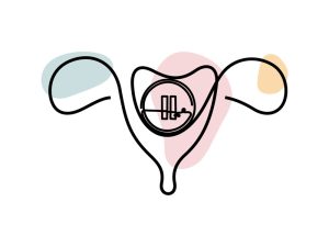 A female uterus with a pause button overlayed indicating a delay or disruption as with POI.